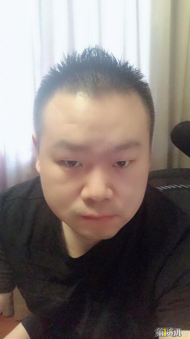 岳云鹏晒稀拉头发 网友表示：秃如其来